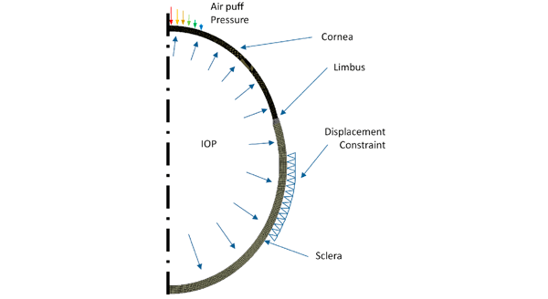 corneal-response