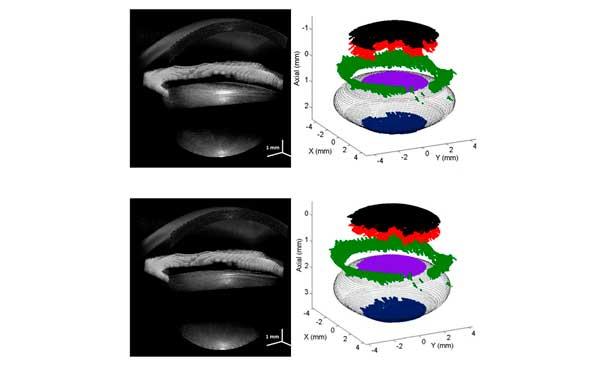 optical-coherence