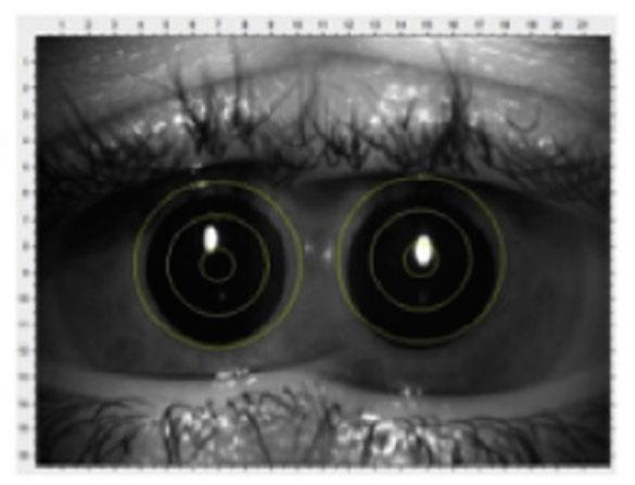 vision1