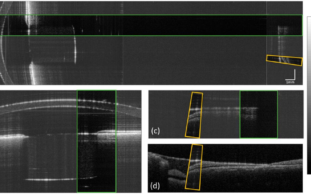 Optical beam scanner with reconfigurable non-mechanical control of beam position, angle, and focus for low-cost whole-eye OCT imaging